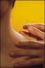 Can acupuncture help lower blood pressure?